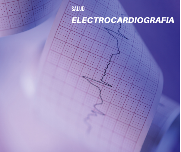 Electrocardiograma